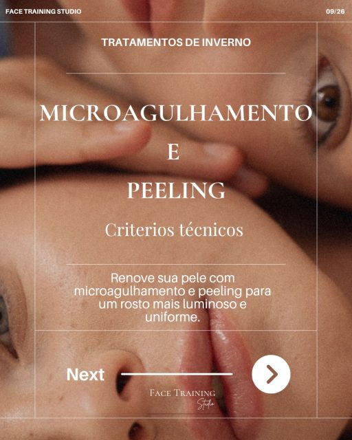 Sabia que a sua pele consegue regenerar-se como se tivesse dez anos a menos? O segredo não é magia, é ciência aplicada com sensibilidade.

✨MICROAGULHAMENTO
Micro perfurações controladas que “enganam” a pele, levando-a a acreditar que precisa de se reconstruir. O resultado? Colagénio novo, poros mais discretos, textura renovada e aquele viço que só se consegue de dentro para fora.
✨PEELING
Remove, camada a camada, tudo o que já não serve — células mortas, manchas, marcas de acne, sinais de cansaço. Como uma página em branco para a sua pele recomeçar.
Combinados, são um dos duetos mais eficazes da estética facial: um renova em profundidade, o outro revela à superfície. Menos maquilhagem, mais confiança.

Porque os tratamentos invasivos transformam por dentro, e nós cuidamos do que se vê por fora.

🎉 CAMPANHA DESTE MÊS
Só até final do mês: 20% de desconto em Microagulhamento e Peeling.

📍 Face Training Studio — Linda-a-Velha
📲 Marque já a sua sessão — as vagas são limitadas!
#MicroagulhamentoLisboa #PeelingFacial #FaceTrainingStudio #EstéticaLisboa #PeleSaudável LindaAVelha