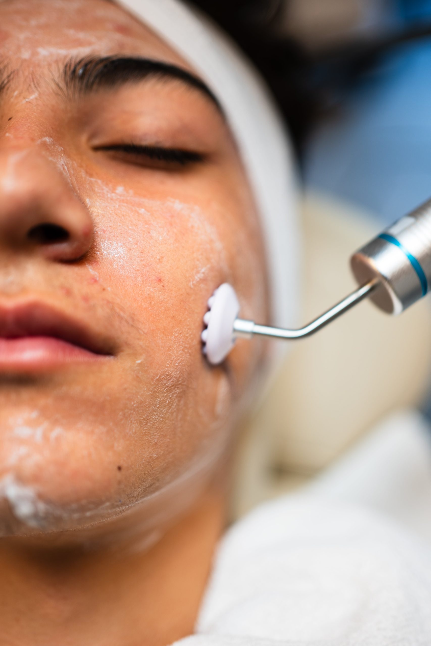 Limpeza de Pele: Porque deve fazer?